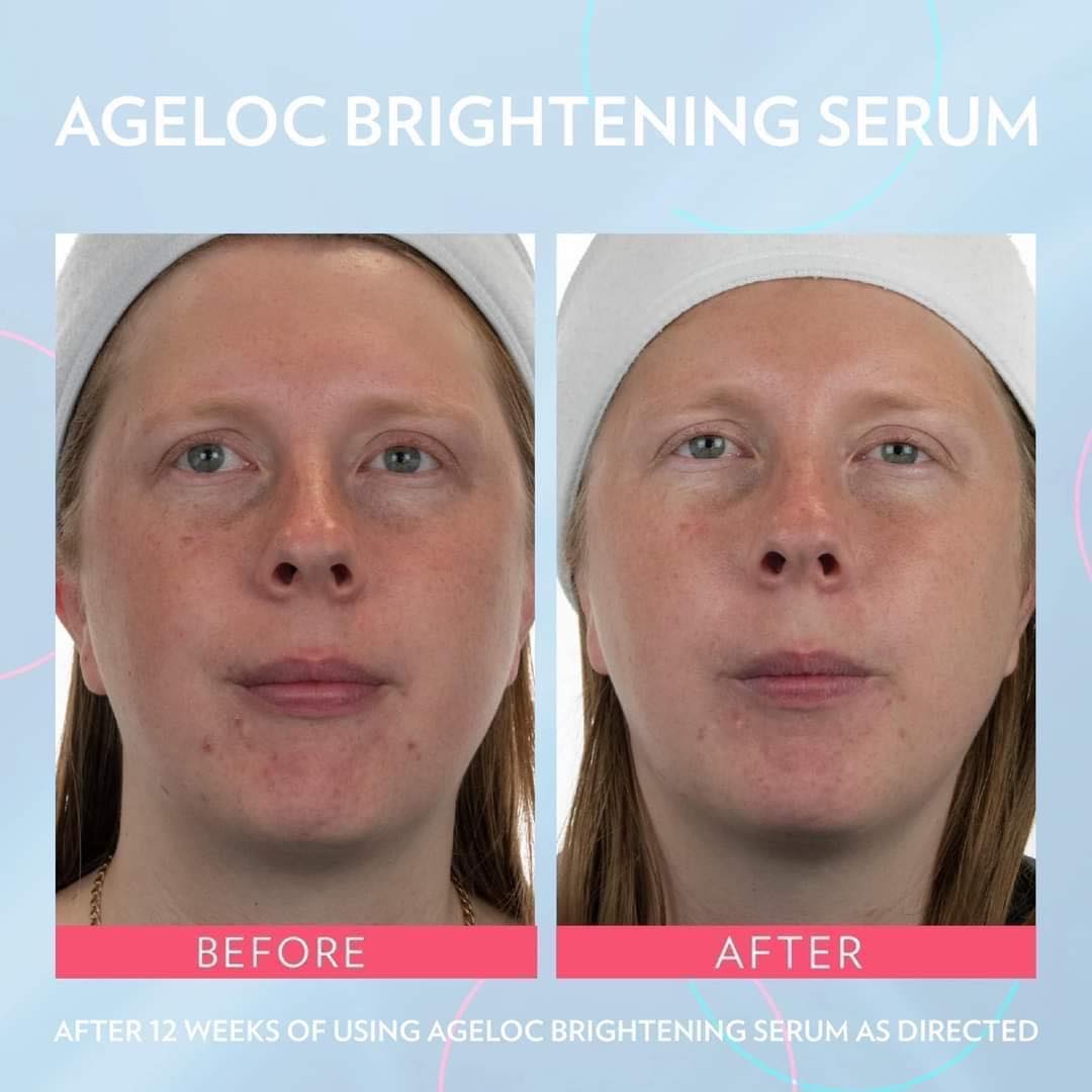 ageLOC Brightening Serum